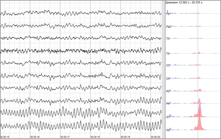 neurofeedback brainwave